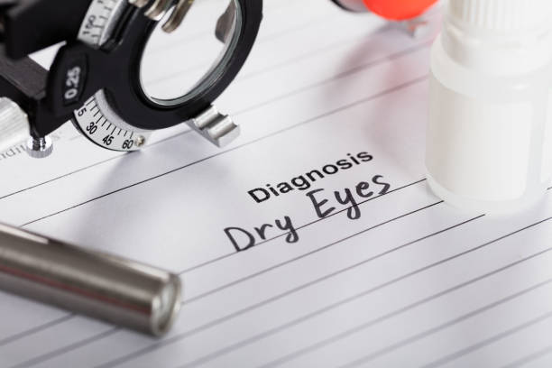 Dry Eyes? Treatments That Actually Work (Feel Relief Fast!)